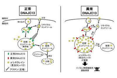 遺伝性パーキンソン病、東北大が発症メカニズム解明 悪玉