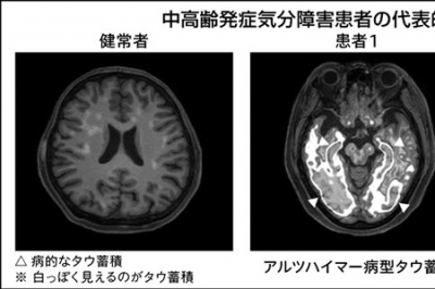 mri様 リクエスト 2点 まとめ商品 （限定版 肝胆膵の画像診断