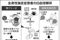 阪大、全身性強皮症の免疫解析 臓器ごとに遺伝子発現を発見 | 日刊工業新聞 電子版